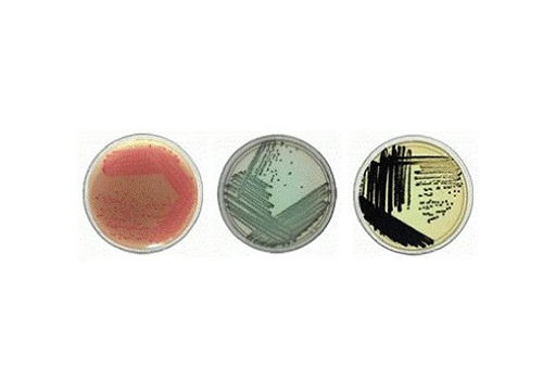 Microbial Detection Using Chromogenic Media